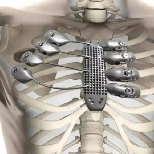 煙臺(tái)鈦合金用于醫(yī)療